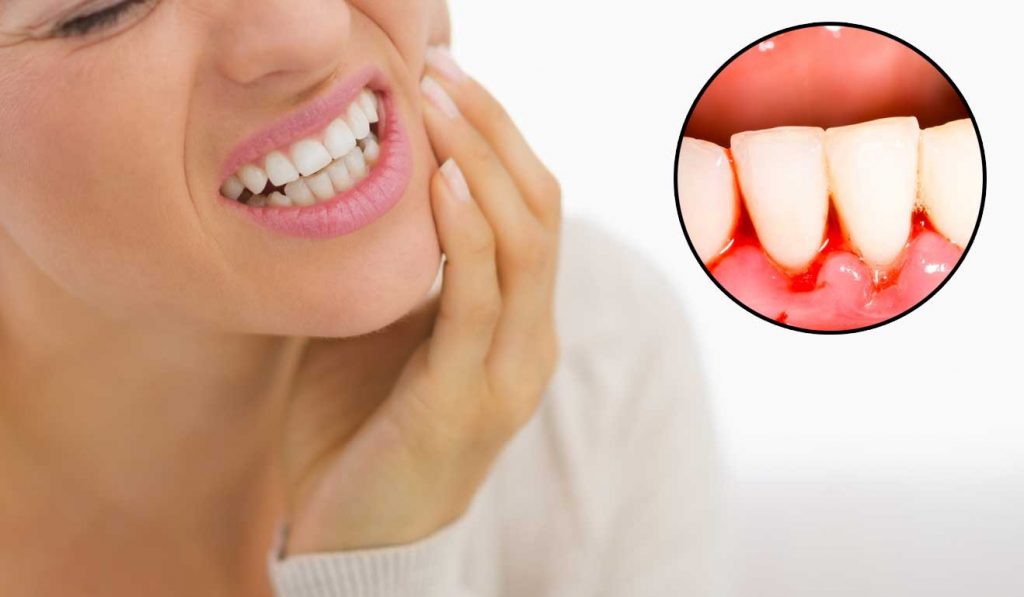 Why do the gums ache after teeth restoration?
